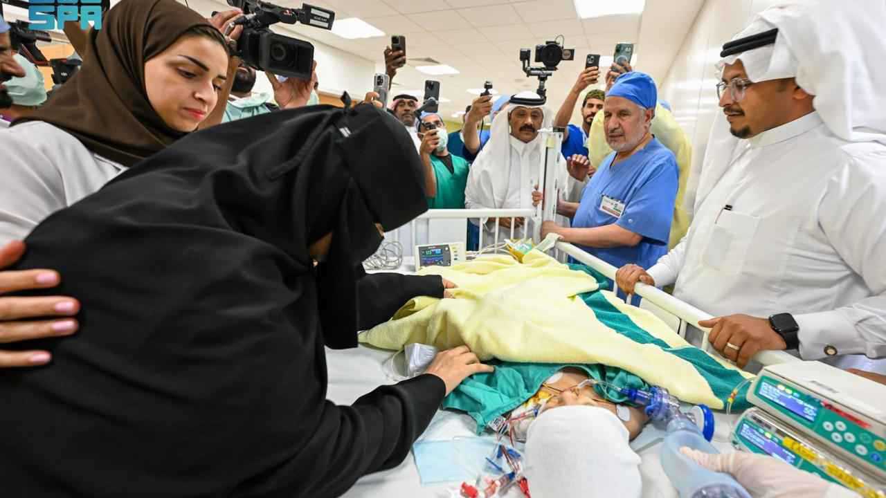 السعودية تحقق إنجازاً طبياً: نجاح فصل التوأم الملتصق يارا ولارا في جراحة دقيقة (صور)