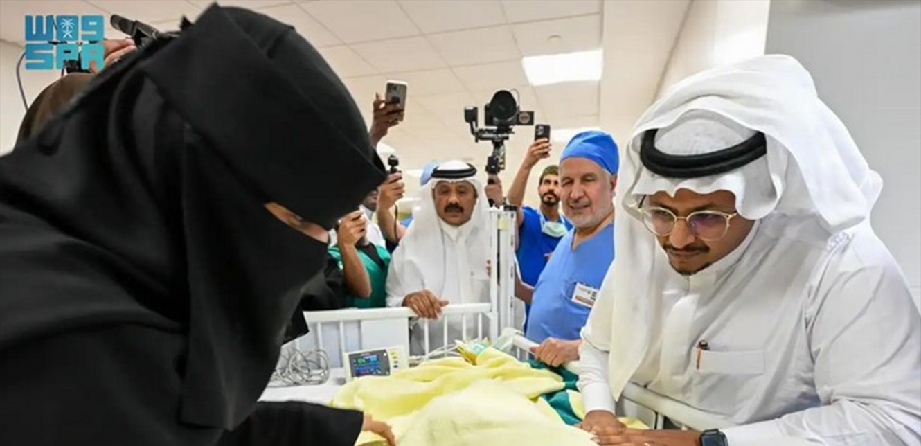 بنجاح: عملية فصل توأم سعودي ملتَصق تتم على مدار 9 مراحل (صور)